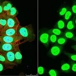 Merck Anti-SNF2β/BRG1 Antibody