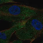 Merck Anti-ACE antibody produced in rabbit