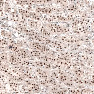 Merck Anti-NR4A3 antibody produced in rabbit