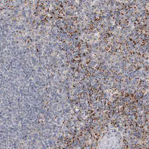 Merck Anti-ALKBH8 antibody produced in rabbit