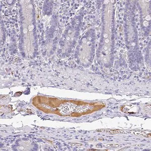 Merck Anti-APOB antibody produced in rabbit
