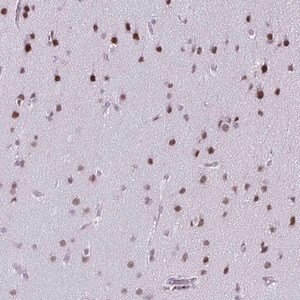 Merck Anti-SS18 antibody produced in rabbit