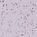 Merck Anti-SS18 antibody produced in rabbit