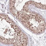 Merck Anti-ITPKC antibody produced in rabbit