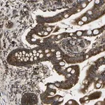 Merck Anti-SLC39A14 antibody produced in rabbit