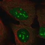 Merck Anti-DUX4 antibody produced in rabbit