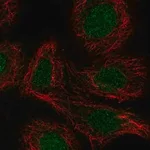 Merck Anti-RARA antibody produced in rabbit