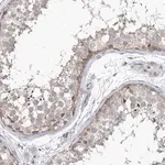Merck Anti-PHF20L1 antibody produced in rabbit