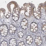 Merck Anti-SEMA3D antibody produced in rabbit