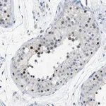 Merck Anti-FAM208A antibody produced in rabbit