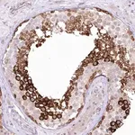 Merck Anti-YBX3 antibody produced in rabbit