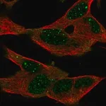 Merck Anti-GPR155 antibody produced in rabbit