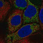 Merck Anti-HKDC1 antibody produced in rabbit
