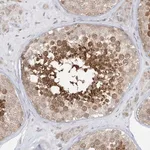 Merck Anti-KANSL3 antibody produced in rabbit