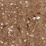 Merck Anti-SLC25A22 antibody produced in rabbit