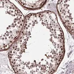 Merck Anti-PSME4 antibody produced in rabbit