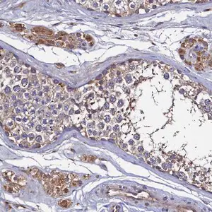 Merck Anti-TK2 antibody produced in rabbit