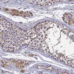 Merck Anti-TK2 antibody produced in rabbit
