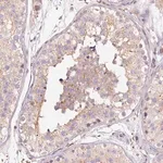 Merck Anti-PRRC2A antibody produced in rabbit