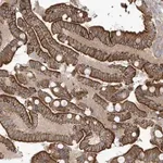Merck Anti-NAV3 antibody produced in rabbit