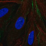 Merck Anti-MTMR9 antibody produced in rabbit