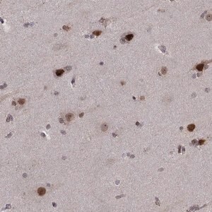 Merck Anti-PSMC2 antibody produced in rabbit