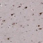 Merck Anti-PSMC2 antibody produced in rabbit