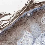 Merck Anti-S100A7 antibody produced in rabbit