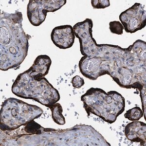 Merck Anti-TMEM131 antibody produced in rabbit