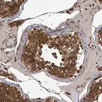 Merck Anti-KLC1 antibody produced in rabbit