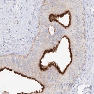 Merck Anti-SLC5A6 antibody produced in rabbit