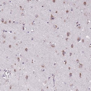 Merck Anti-TMEM106B antibody produced in rabbit