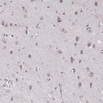 Merck Anti-TMEM106B antibody produced in rabbit
