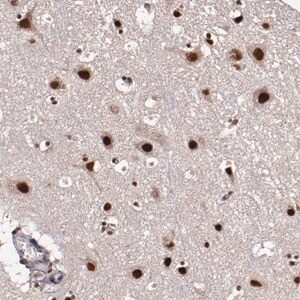 Merck Anti-CECR2 antibody produced in rabbit