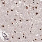 Merck Anti-CECR2 antibody produced in rabbit