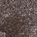 Merck Anti-RFX5 antibody produced in rabbit