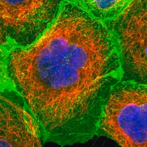 Merck Anti-ERBB2 antibody produced in rabbit