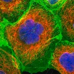 Merck Anti-ERBB2 antibody produced in rabbit