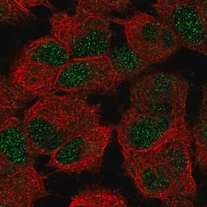 Merck Anti-CERS6 antibody produced in rabbit