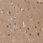 Merck Anti-KIF21B antibody produced in rabbit