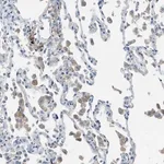 Merck Anti-HEG1 antibody produced in rabbit