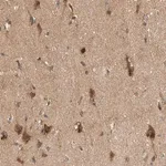 Merck Anti-PXK antibody produced in rabbit