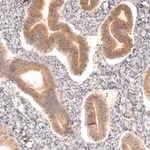 Merck Anti-DICER1 antibody produced in rabbit