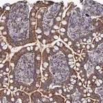 Merck Anti-AQP11 antibody produced in rabbit