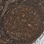 Merck Anti-ARPC2 antibody produced in rabbit