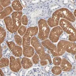 Merck Anti-ZDHHC8 antibody produced in rabbit