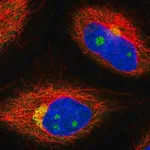 Merck Anti-NCOA4 antibody produced in rabbit