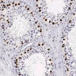 Merck Anti-HMGN5 antibody produced in rabbit
