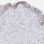 Merck Anti-SRSF3 antibody produced in rabbit