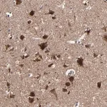Merck Anti-BNIP3 antibody produced in rabbit
